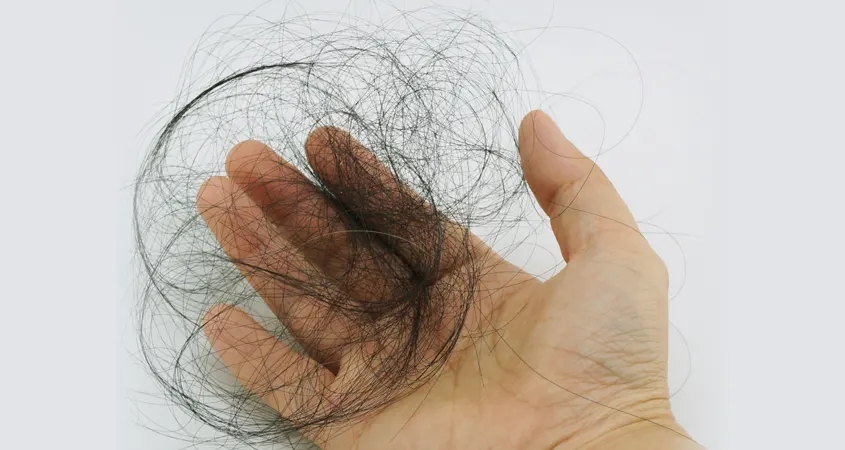 hairfall hairfall